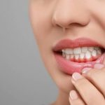 التهاب اللثة.. أسباب شائعة وعلامات تستدعي زيارة طبيب الأسنان