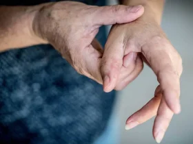 7 أطعمة ومشروبات قد تزيد أعراض التهاب المفاصل.. تعرف على البدائل المناسبة