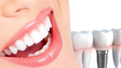 4 حالات يمنع فيها إجراء عمليات زراعة الأسنان