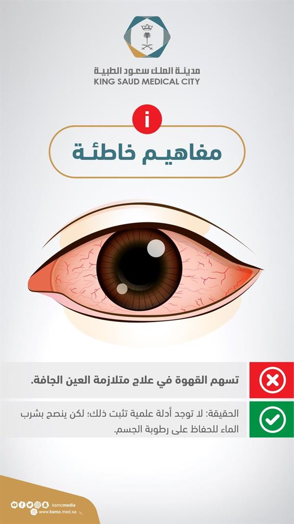 «سعود الطبية » تكشف حقيقة استخدام القهوة في علاج متلازمة العين الجافة