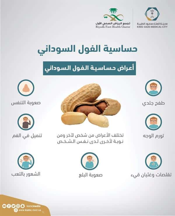 «سعود الطبية» تحذر من حساسية الفول السوداني