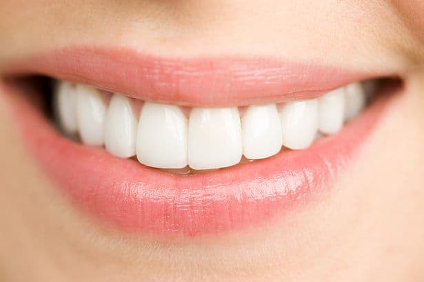 مشاكل حشوات الأسنان وطريقة الحفاظ على ابتسامة هوليود