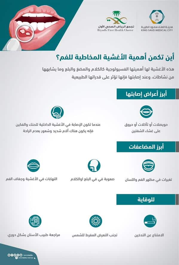 كيفية الحماية من الإصابة بالأغشية المخاطية للفم .. «سعود الطبية» توضح