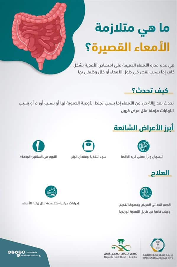 ما هي متلازمة الأمعاء القصيرة وأعراضها؟.. «سعود الطبية» توضح