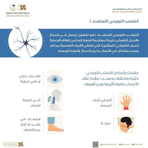 أعراض التصلب اللويحي المتعدد .. «فهد الطبية» توضح