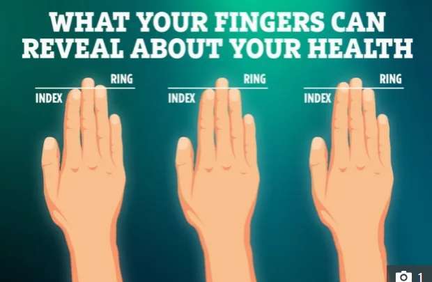 طول الأصابع يمكن أن يكون مؤشرًا على الإصابة بأمراض نفسية معينة